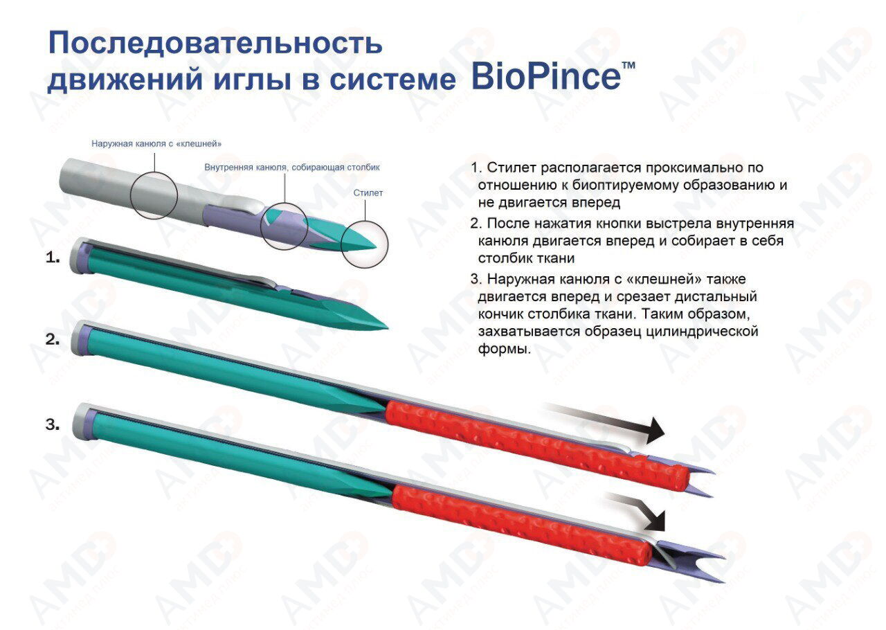 biopince_9