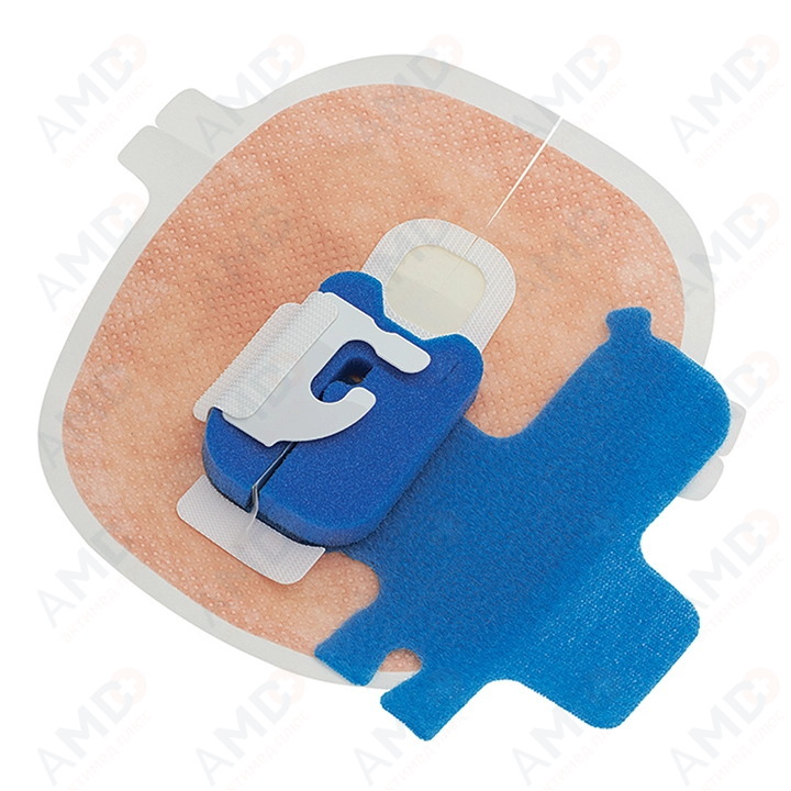 фиксация_катетера_артикул_802500001_01 фиксация_катетера_артикул_802500001_01